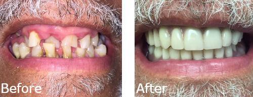 Willow Glen Dental Care Willow Glen Dental Care