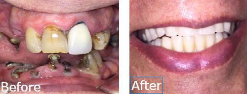 Willow Glen Dental Care Willow Glen Dental Care