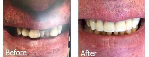 Willow Glen Dental Care Willow Glen Dental Care