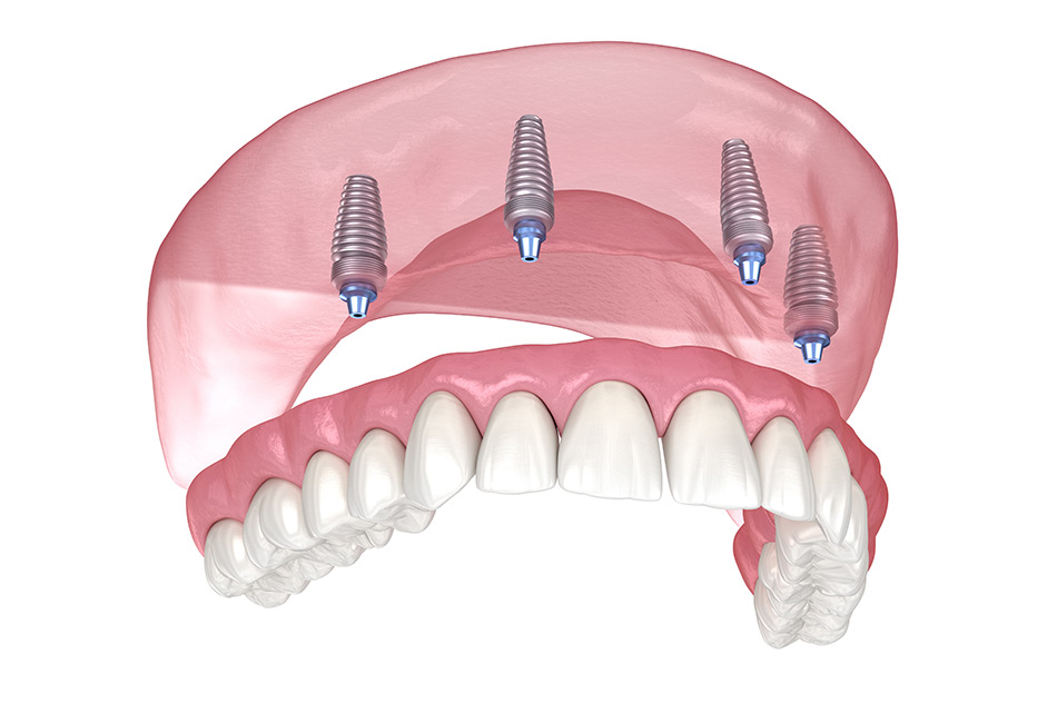 Willow Glen Dental Care Willow Glen Dental Care