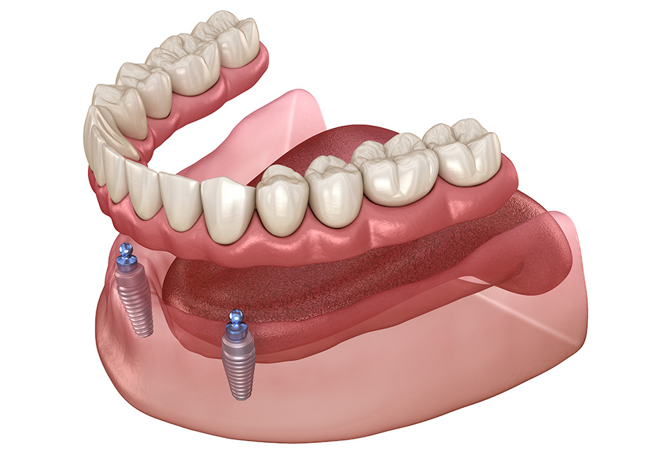 Willow Glen Dental Care Willow Glen Dental Care