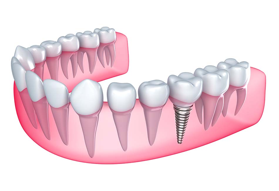 Willow Glen Dental Care Willow Glen Dental Care